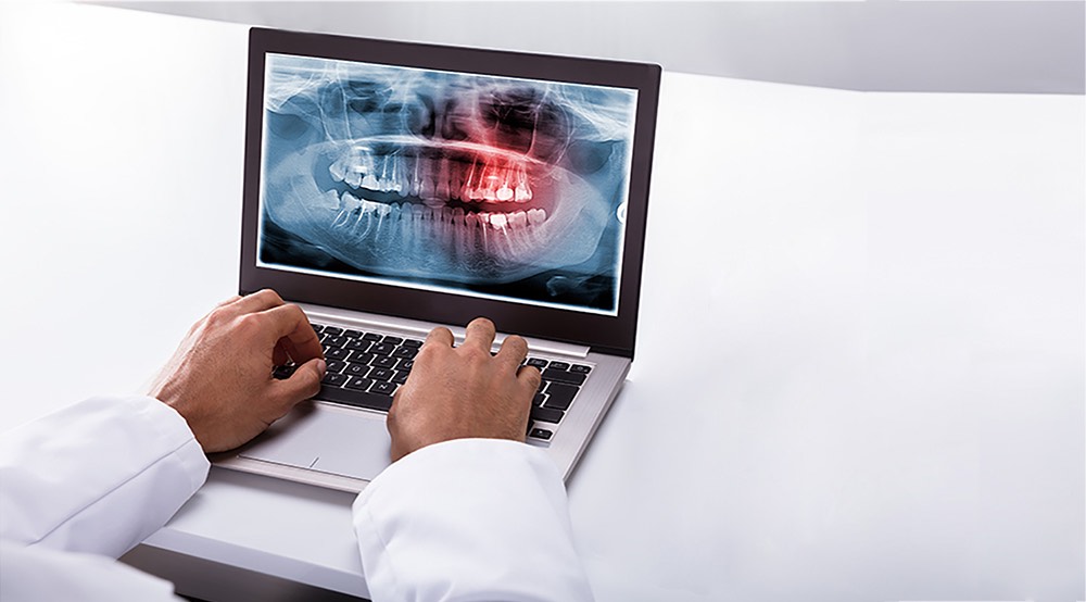State Of The Art Digital X-Rays in Johnsburg | Prime Dental Associates